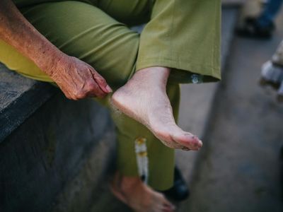 Person hands resting on knees in meditation posture